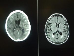 verschil CT MRI