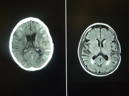 Het verschil tussen een MRI en een CT scan? - Enurse.nl